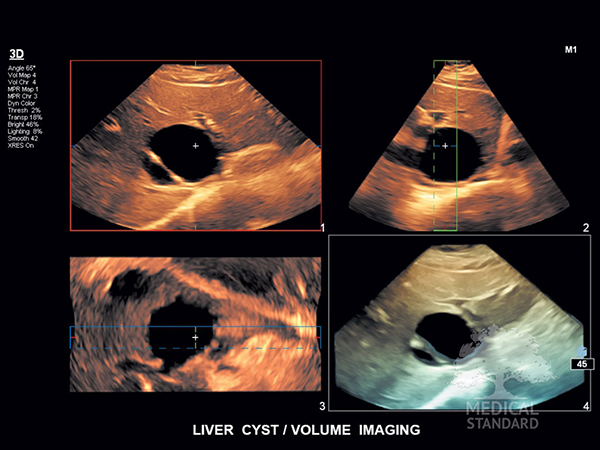 Ультразвуковая система Philips EPIQ 7