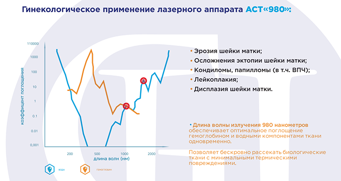 Гинекологический лазер АСТ 980 - аппарат для резекции и коагуляции