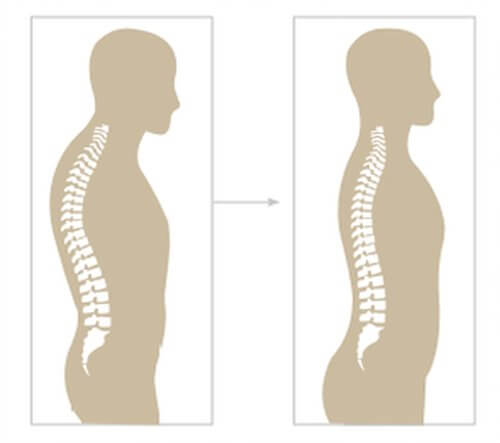 Super Inductive System (SIS) BTL аппарат высокоинтенсивной магнитотерапии для суставов