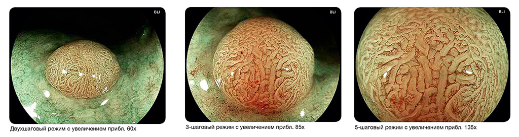 ELUXEO 7000 Fujifilm - Купить эндоскопическую видеосистему