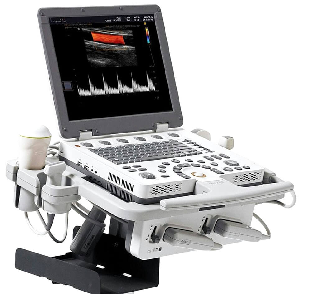 Ультразвуковой аппарат MySono U6 Samsung Medison