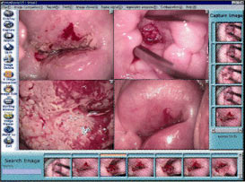 Dr. Camscope DCS-102 купить видеокольпоскоп - цена по запросу