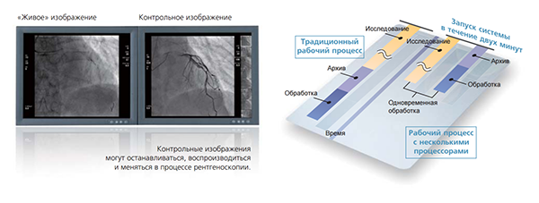 Ангиограф Bransis Alexa Shimadzu - Технологические возможности