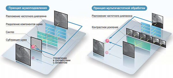 Ангиограф Bransis Alexa Shimadzu с потолочным штативом С-дуги (С12)