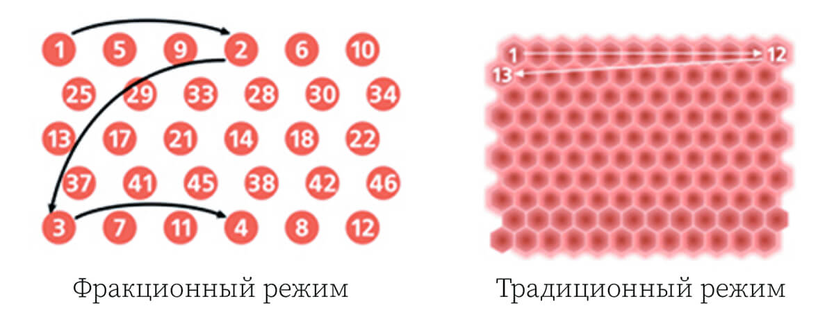 Варианты режимов на косметологическом лазере Slim Evolution II