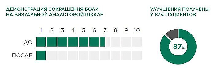 Super Inductive System (SIS) BTL - цена на аппарат высокоинтенсивной магнитотерапии по запросу
