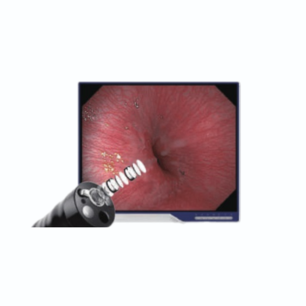 Универсальная видеоэндоскопическая система (эндоскопическая стойка) Aohua AQ 90