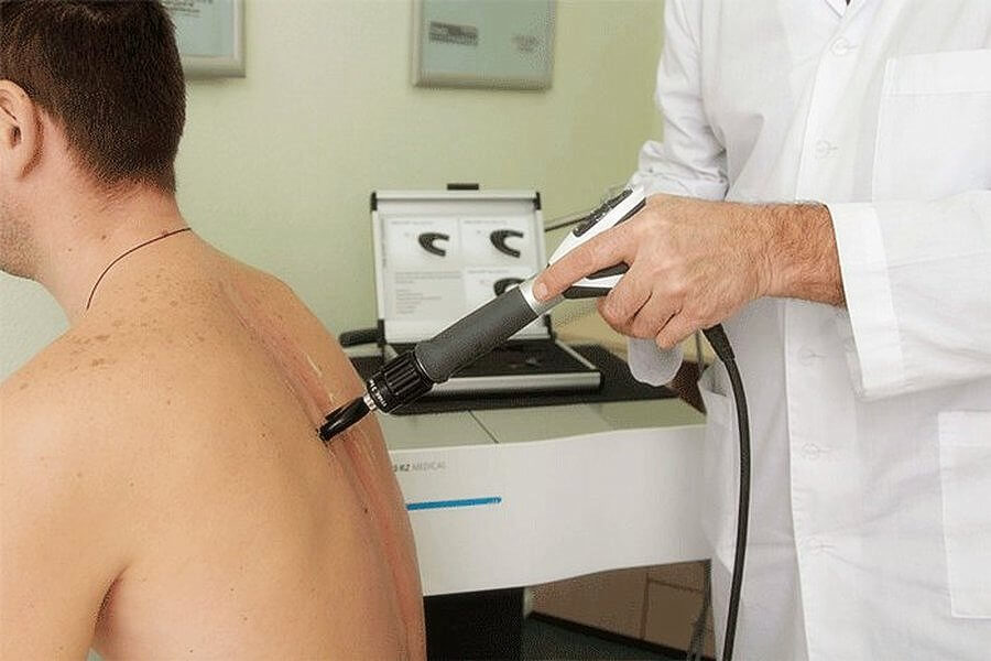 Обработка околопозвоночных мышц радиальным аппликатором с паравертебральной насадкой Обработка околопозвоночных мышц радиальным аппликатором с паравертебральной насадкой