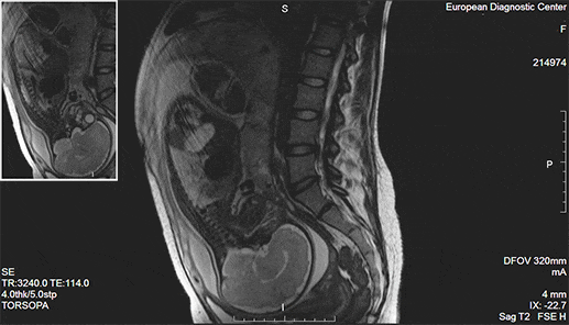 Пример магнитно-резонансной томографии (МРТ)