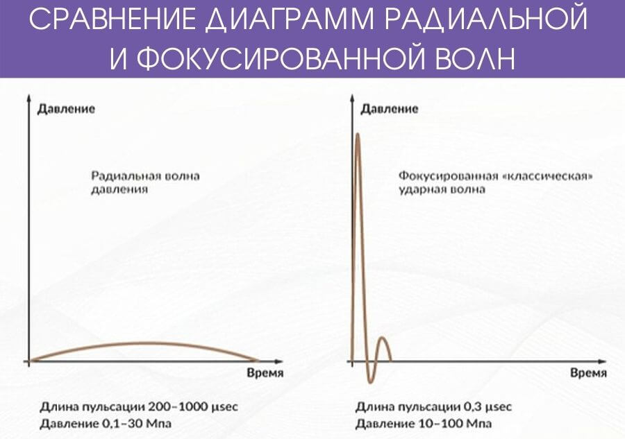 Сравнение характеристик радиальной и фокусированной ударных волн