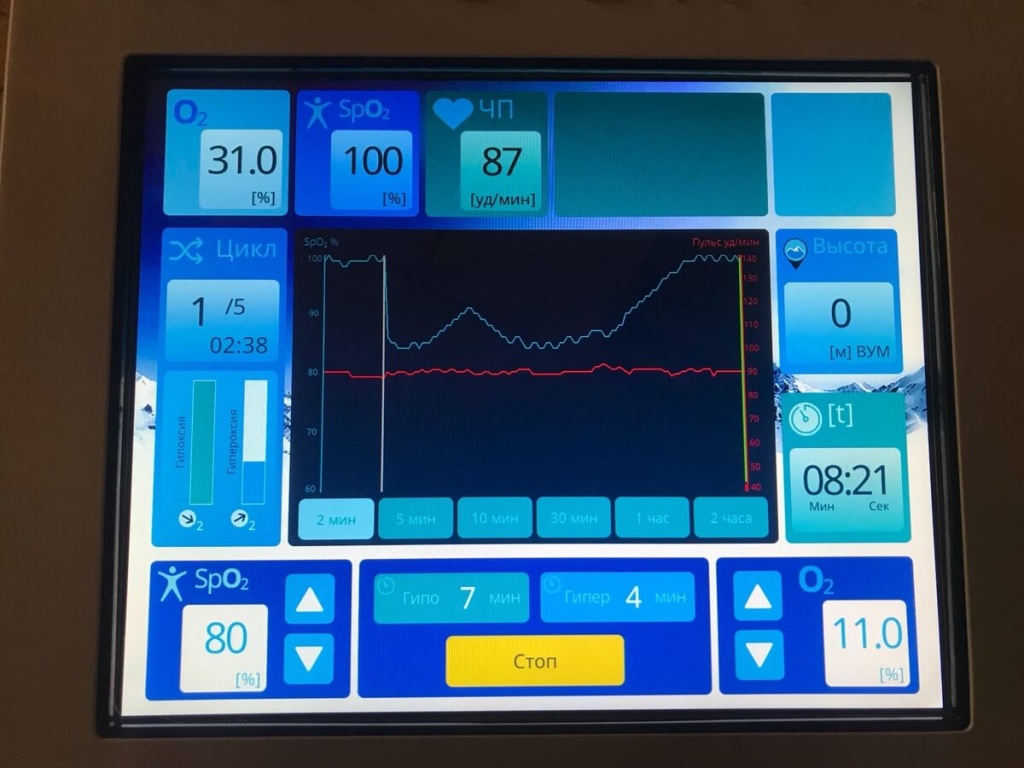 Дисплей с настройками и информацией об пациенете - аппарат Oxyterra Дисплей с настройками и информацией об пациенете - аппарат Oxyterra