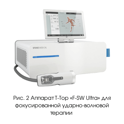 Аппарат УВТ DUOLITH SD1 T-TOP «F-SW Ultra»