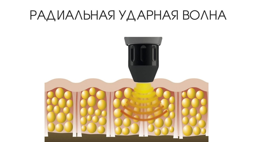 Конфигурация радиальной ударной волны