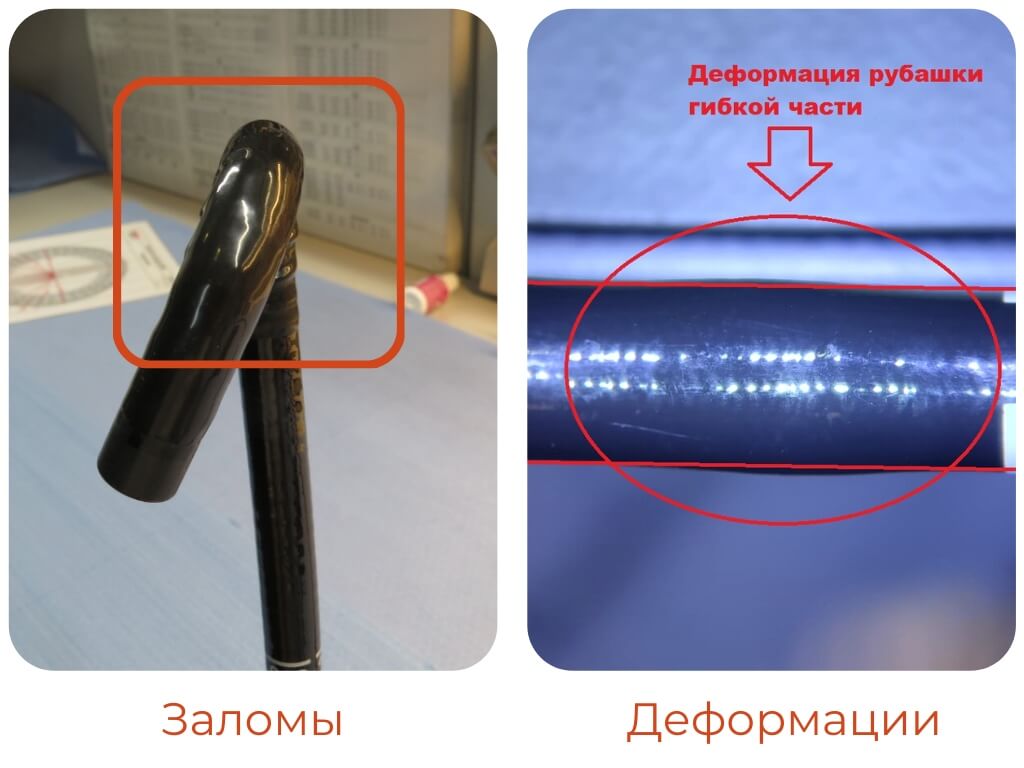 Заломы и деформации медицинских эндоскопов