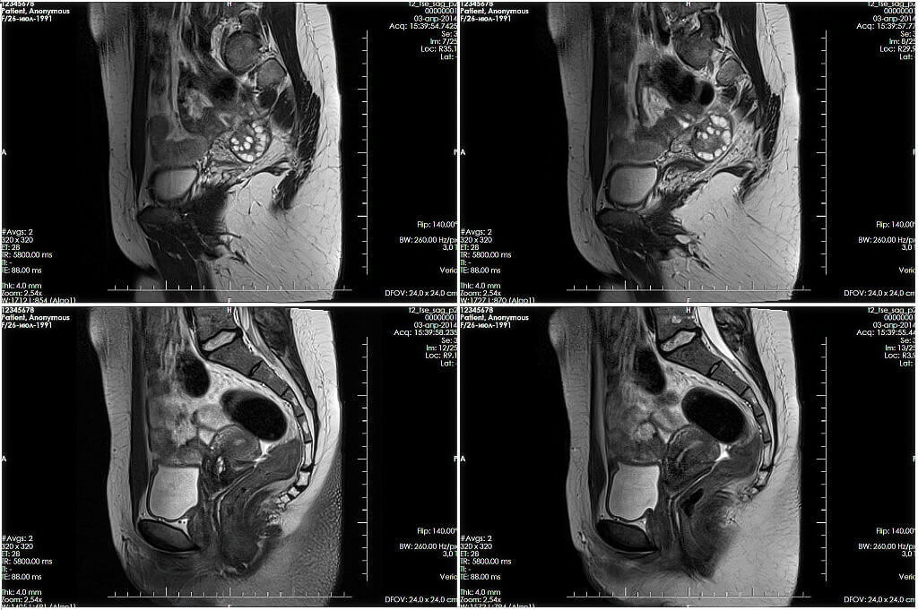 Пример компьютерной томографии (КТ)