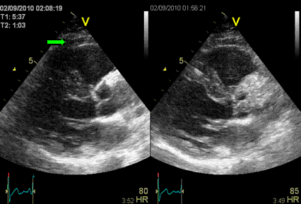 Пример ультразвукового исследования (УЗИ)