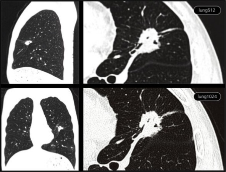 Компьютерный томограф NeuViz 64 Neusoft