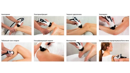 Комбинированный аппарат DUOLITH SD1 T-TOP «F-SW Ultra» и MASTERPULS MP100