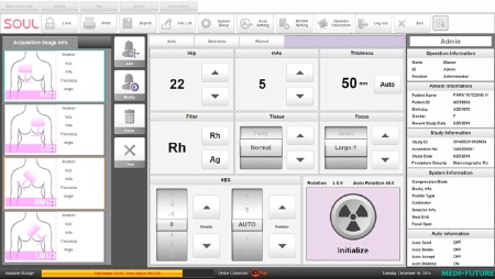 Цифровой маммограф Brestige Expert Indirect