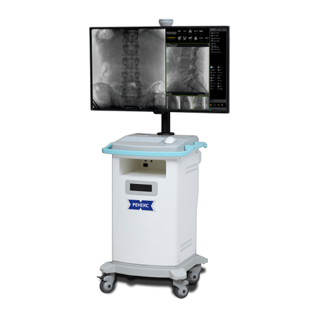 Рентген типа C-дуга «Ренекс» 15 кВт с цифровым ППД - Цена по запросу
