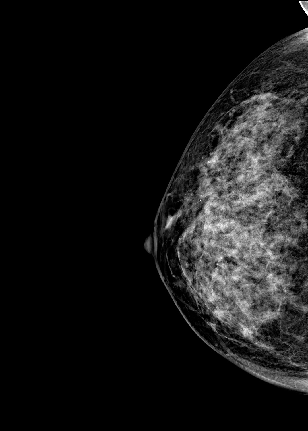 Цифровой маммограф Brestige Expert Indirect