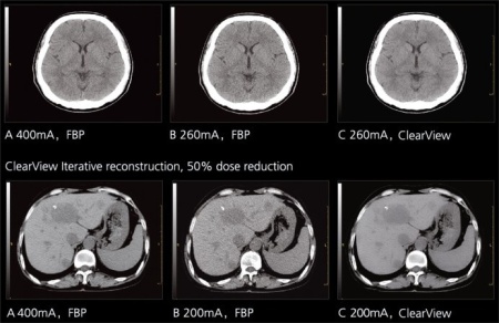 Компьютерный томограф NeuViz 64 Neusoft