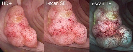 Эндоскопическая экспертная система Pentax Hi Line HD+