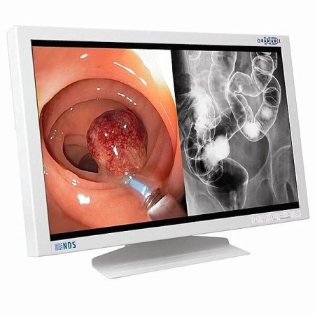 Медицинские мониторы эндоскопические NDS Surgical Imaging