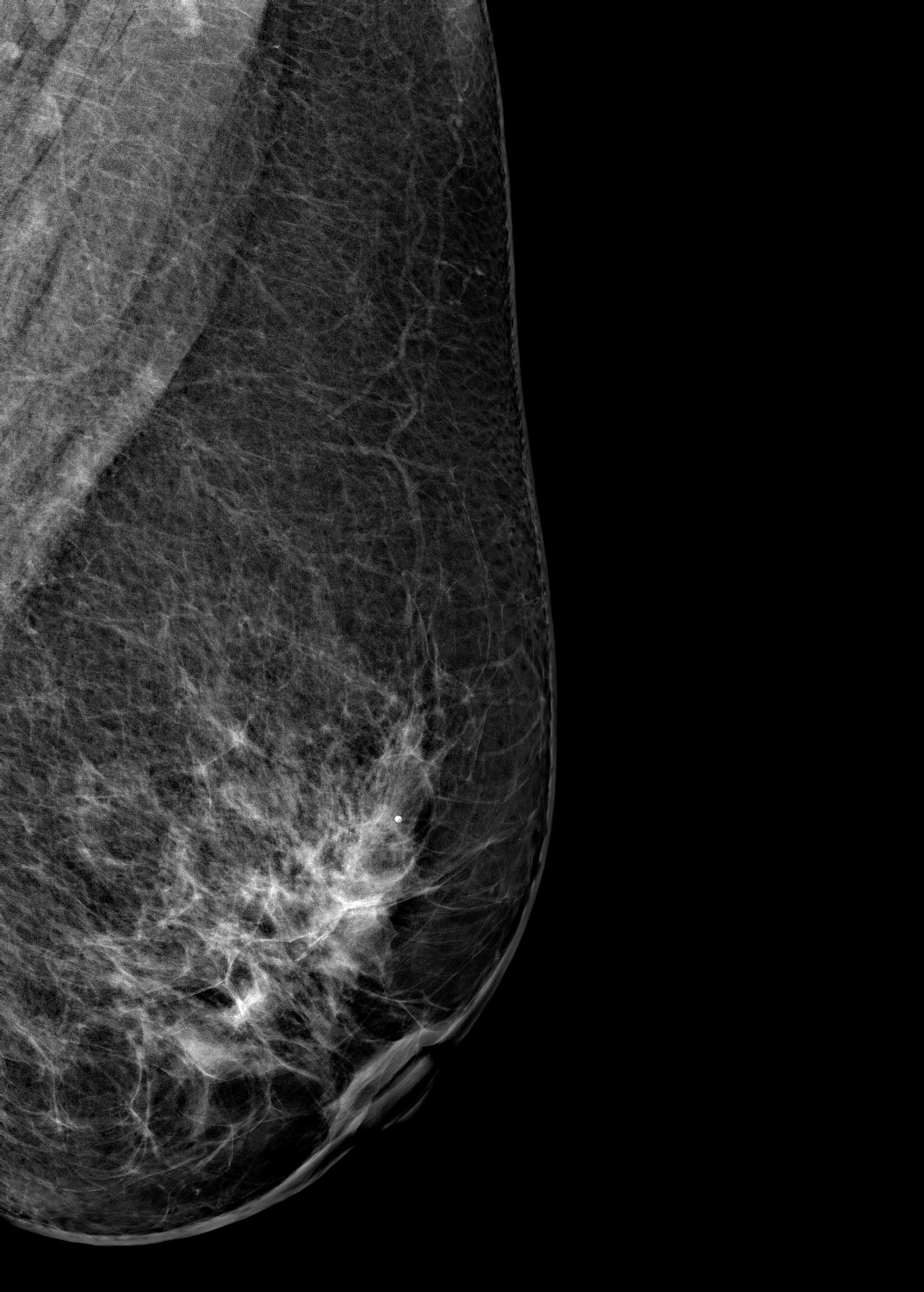 Цифровой маммограф Brestige Expert Indirect