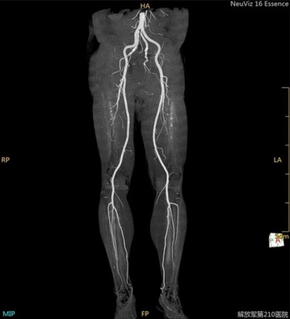 Компьютерный томограф NeuViz 16 Essence Neusoft