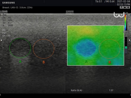 Аппарат УЗИ Samsung Medison HM70 EVO