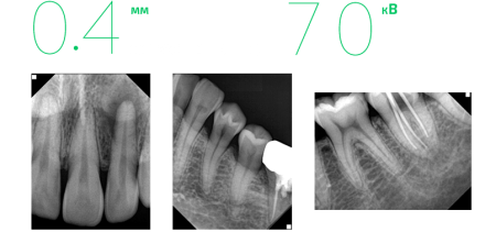 Стоматологический рентген Genoray Port x IV