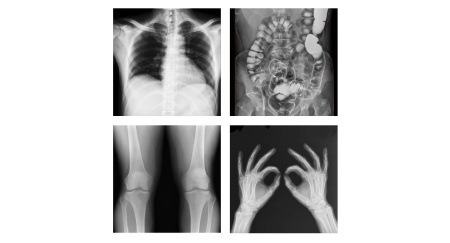 Flexavision F3 Shimadzu - цифровой рентгенодиагностический комплекс