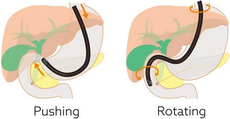 Дуоденоскоп Fujifilm ED-530XT8