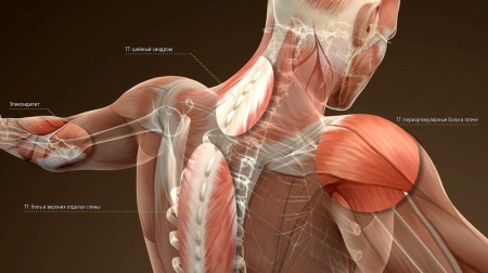 Аппарат ударно-волновой терапии Duolith SD1 T-Top «F-SW Ultra» для урологии