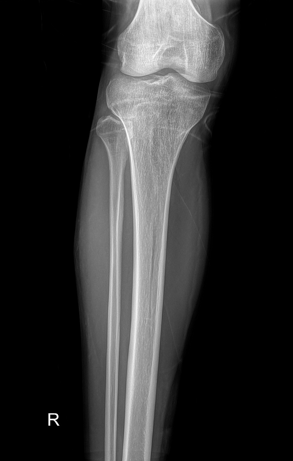 Drgem Diamond PREMIUM - роботизированный рентген аппарат премиум класса