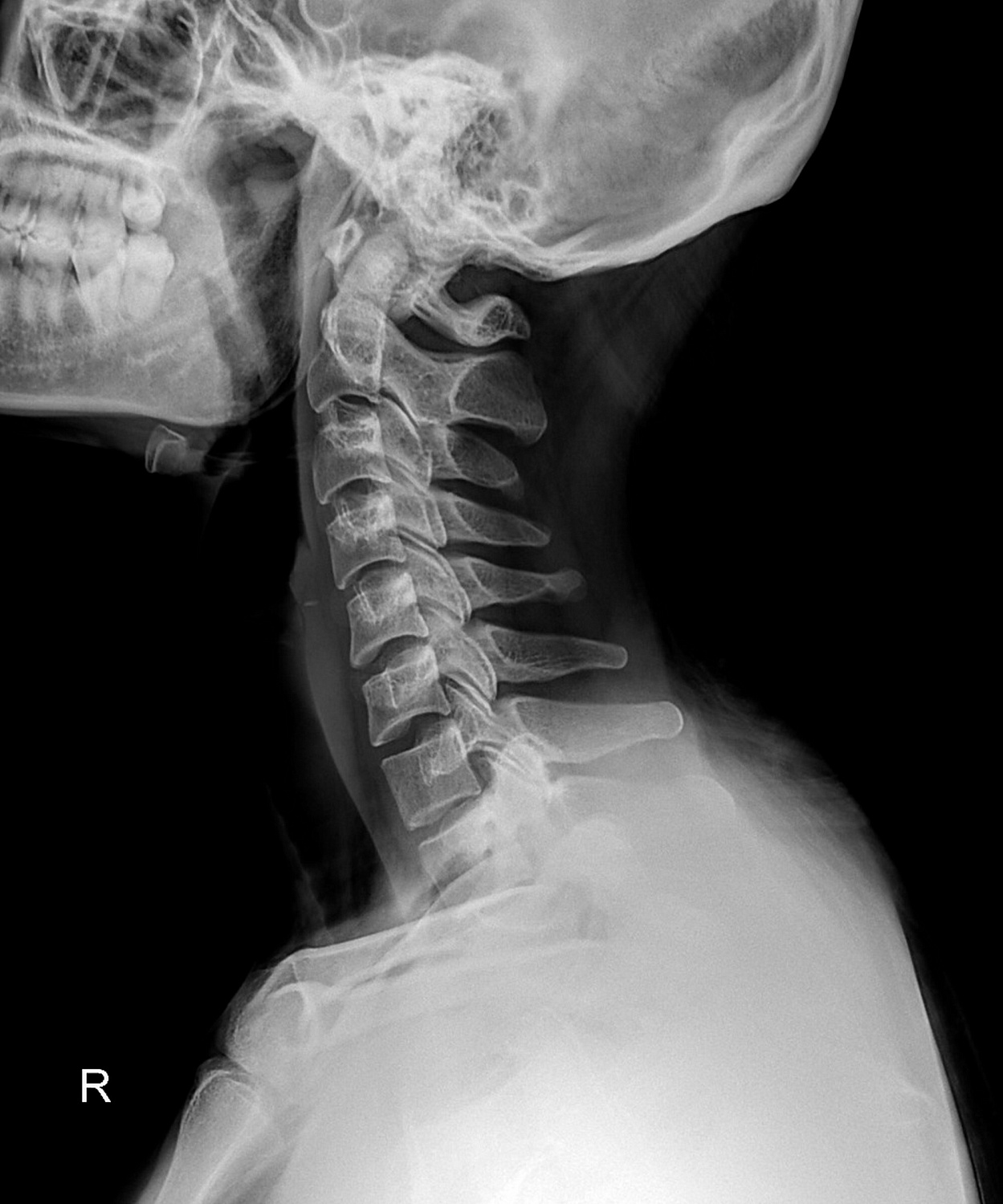 Drgem Diamond PREMIUM - роботизированный рентген аппарат премиум класса