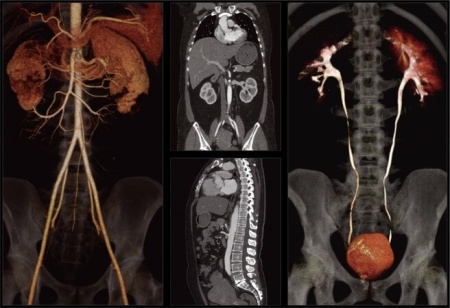 Компьютерный томограф NeuViz 64 Neusoft