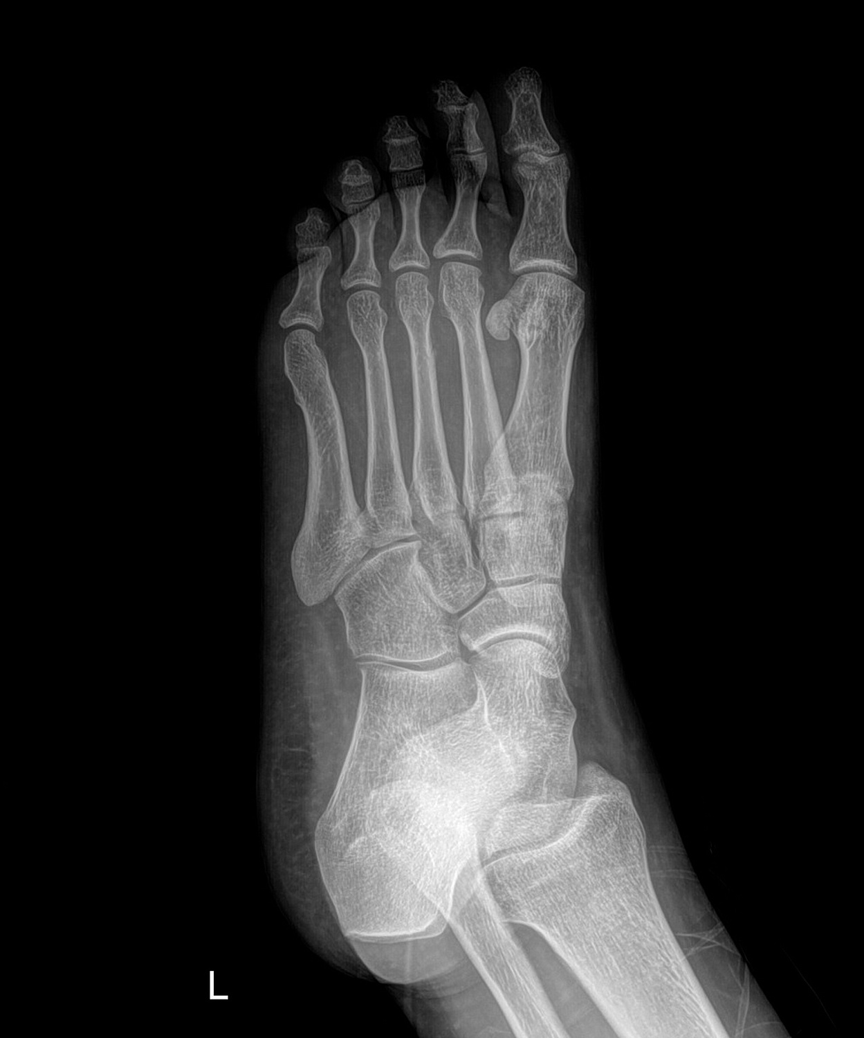 Drgem Diamond PREMIUM - роботизированный рентген аппарат премиум класса