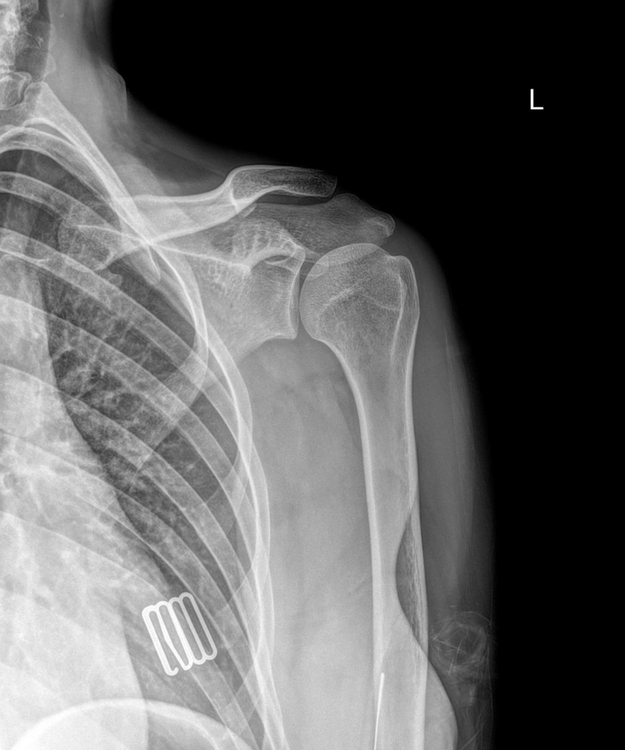 Drgem Diamond PREMIUM - роботизированный рентген аппарат премиум класса