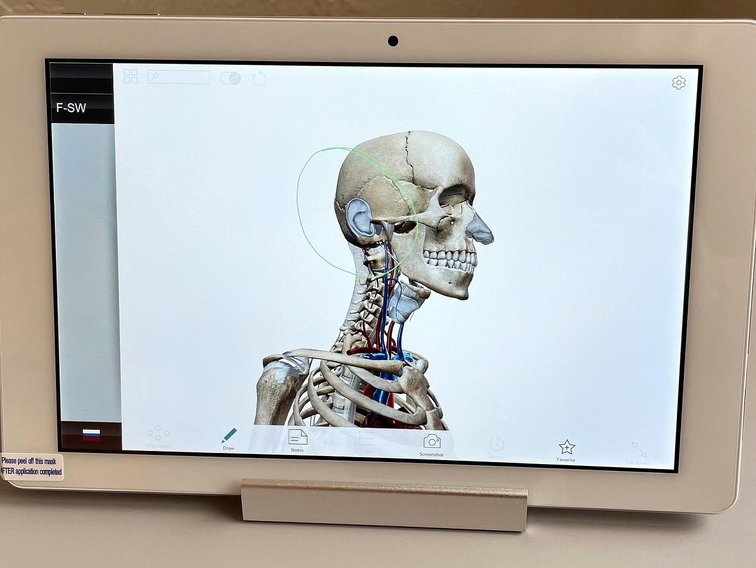 Аппарат ударно-волновой терапии DUOLITH SD1 T-TOP «F-SW Ultra»