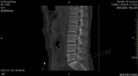 Компьютерный томограф NeuViz 16 Essence Neusoft