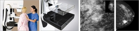 Цифровой маммограф Brestige Expert Indirect