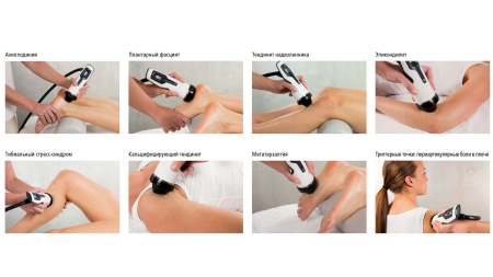 Аппарат ударно-волновой терапии Duolith SD1 T-Top «F-SW Ultra» для урологии