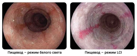 Источник света эндоскопический BL-7000 Fujifilm