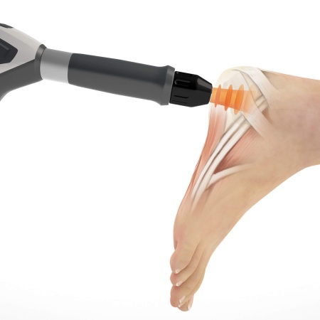 Аппарат ударно-волновой терапии DUOLITH SD1 ULTRA «TOWER»