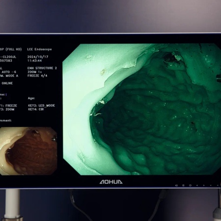 Универсальная видеоэндоскопическая система (эндоскопическая стойка) Aohua AQ 200
