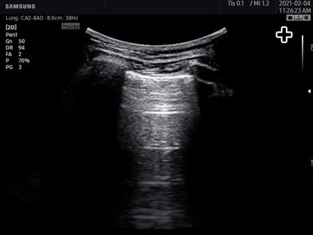 Аппарат УЗИ Samsung Medison HM70 EVO