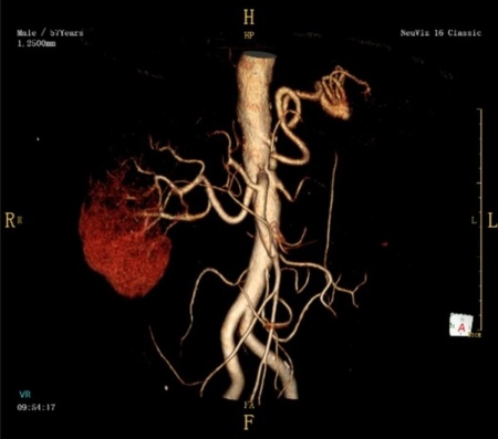 Компьютерный томограф NeuViz 16 Classic CT Neusoft