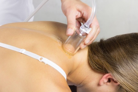 Система вакуумной терапии VACU-ACTOR